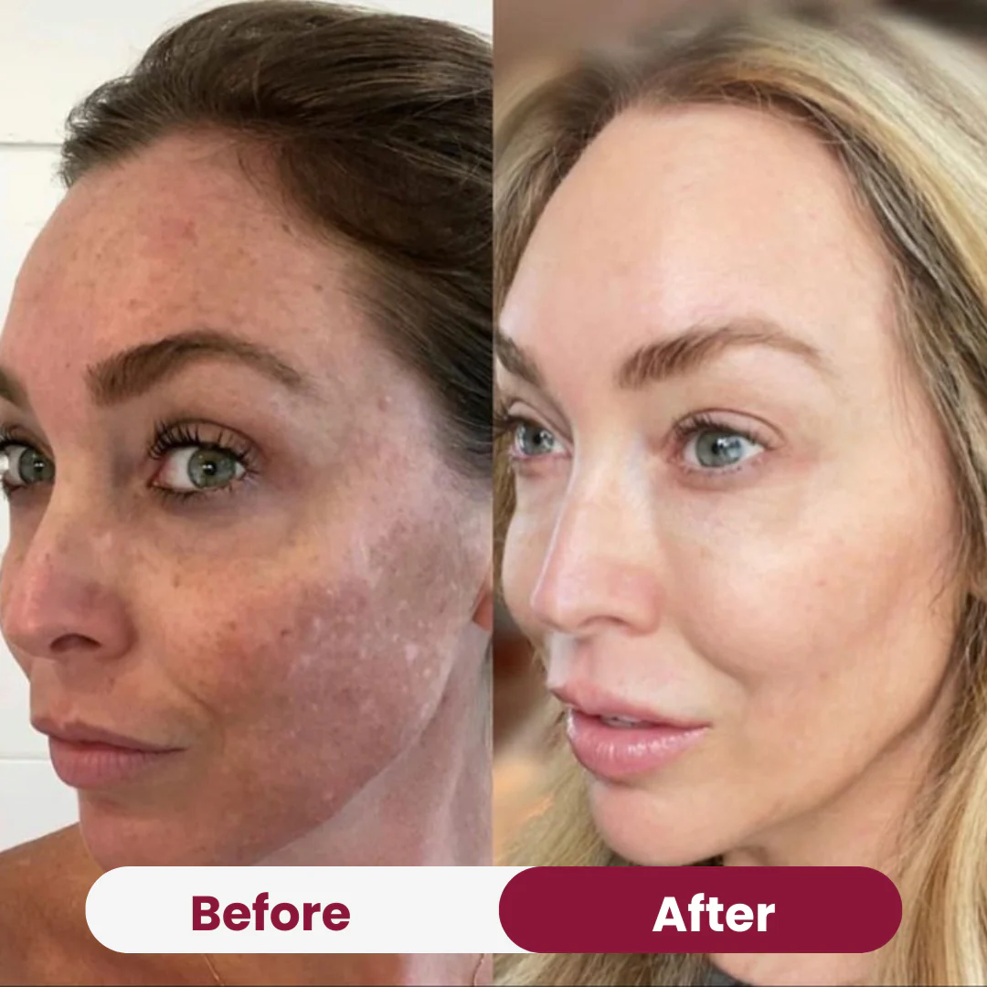 Anti-Aging Power Duo - Image 4