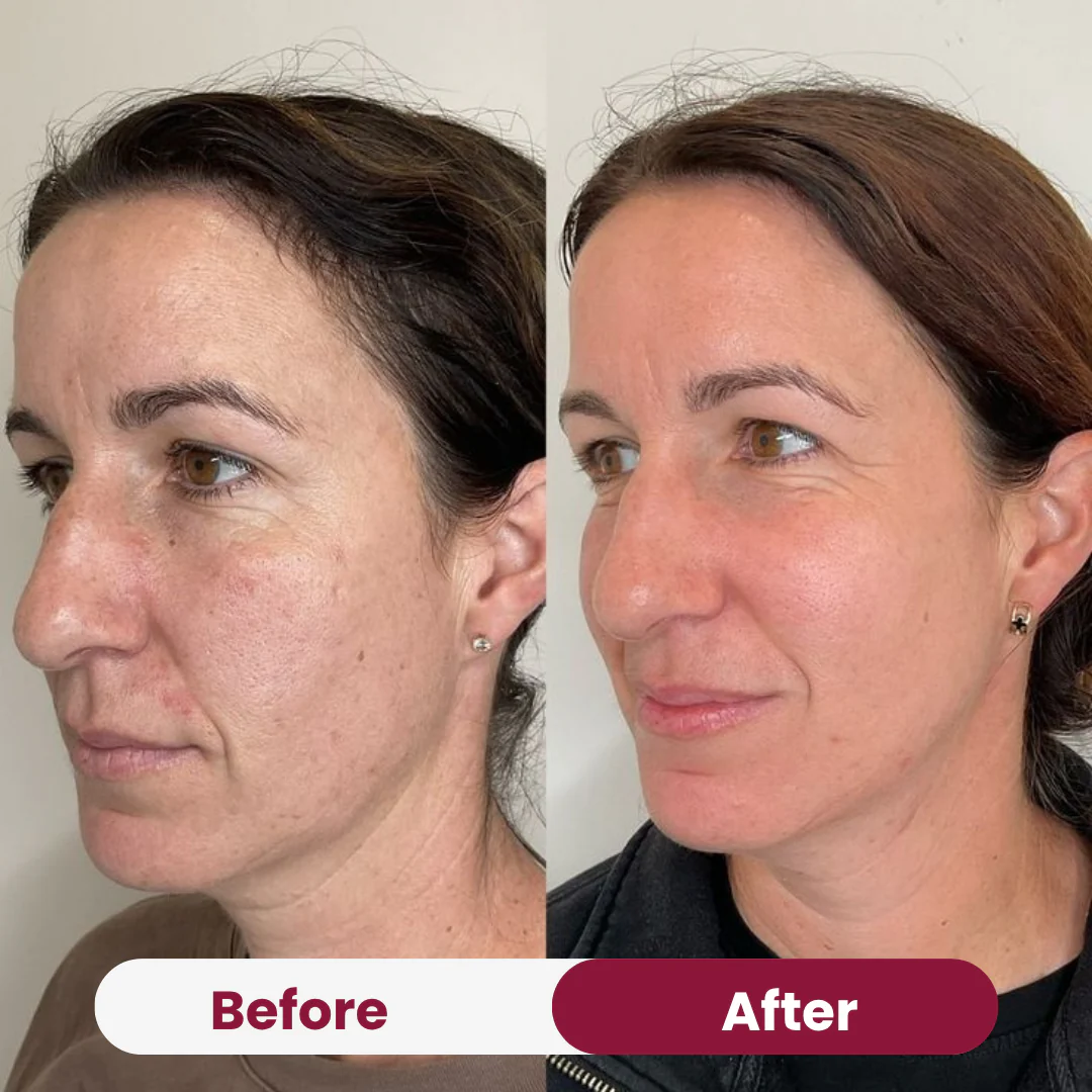 Anti-aging Niacimide 10+ Serum - Image 2