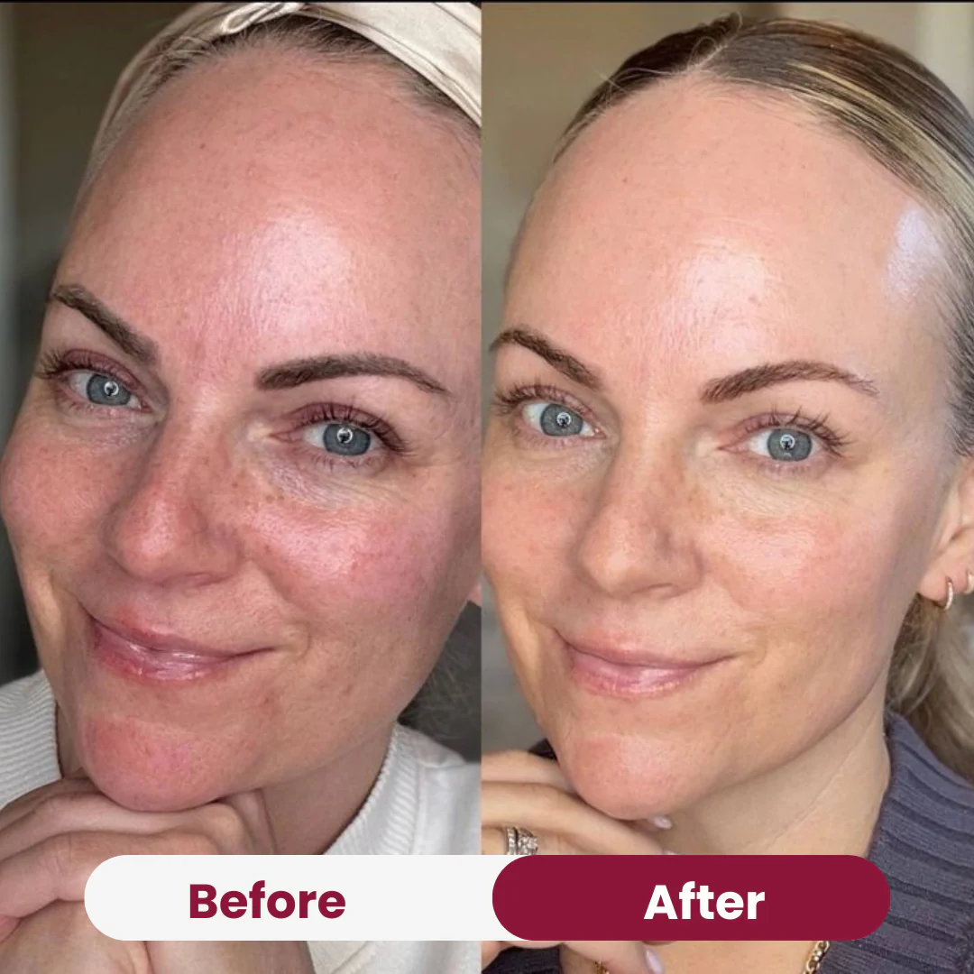 Anti-aging Niacimide 10+ Serum - Image 7