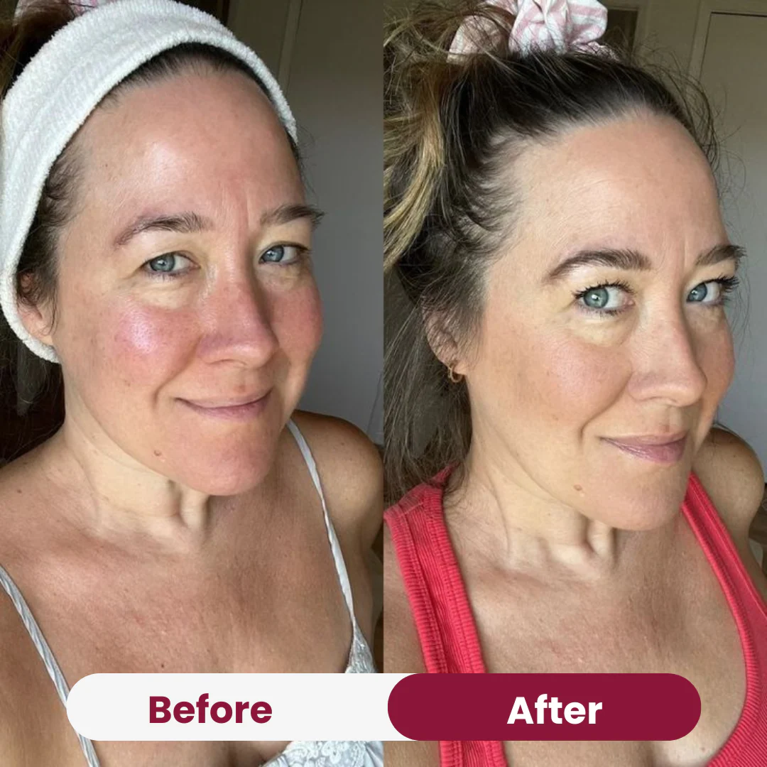 Anti-Wrinkle Collagen Mask Free - Image 3