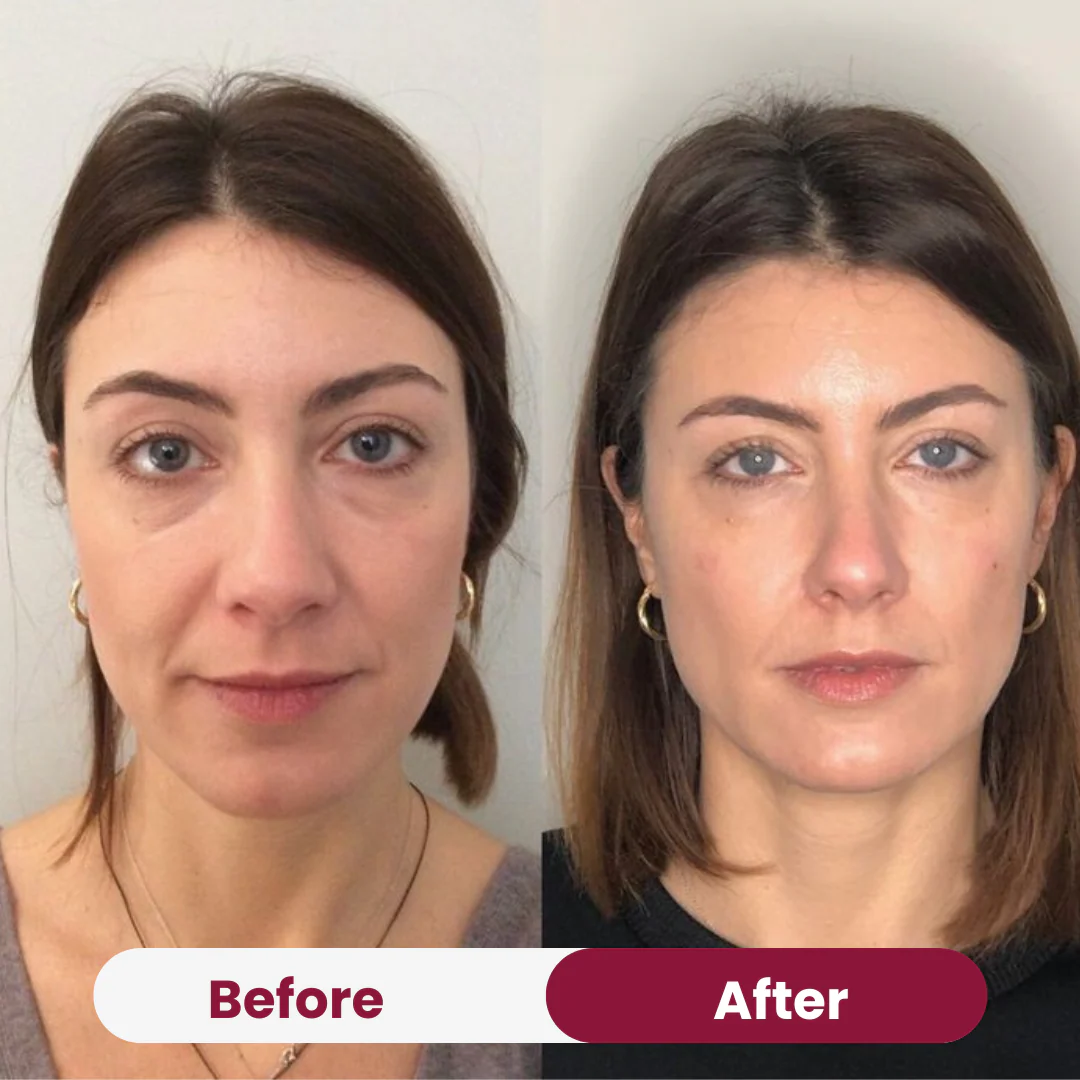 Anti-Wrinkle Collagen Mask Free - Image 8