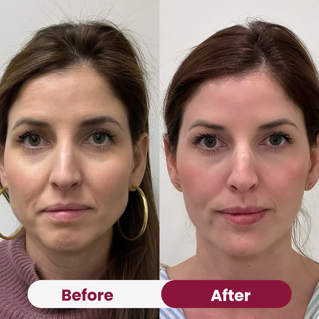 Collagen Peptide Eye Cream - Image 6