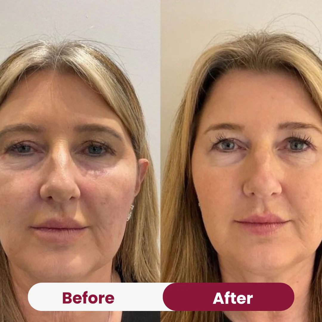 Glow Therapy Duo - Image 3