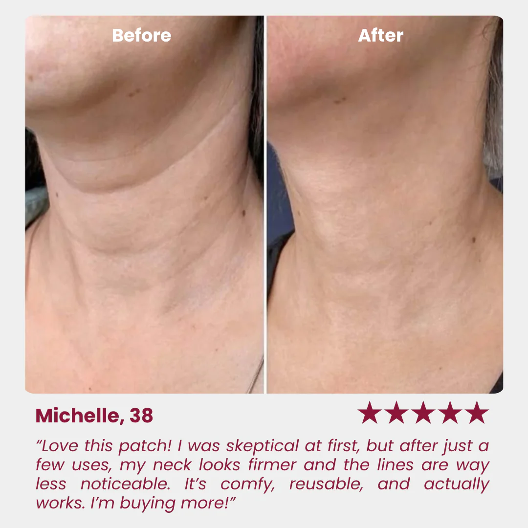 Neck Anti-Wrinkle Patch - Image 3