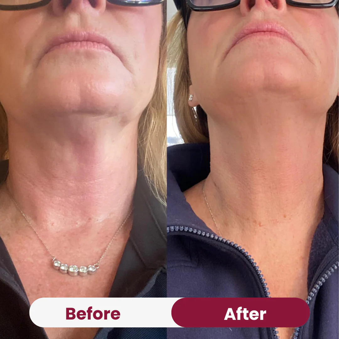Neck Tightening Cream - Image 3