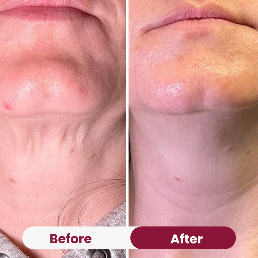 Neck Tightening Cream - Image 6