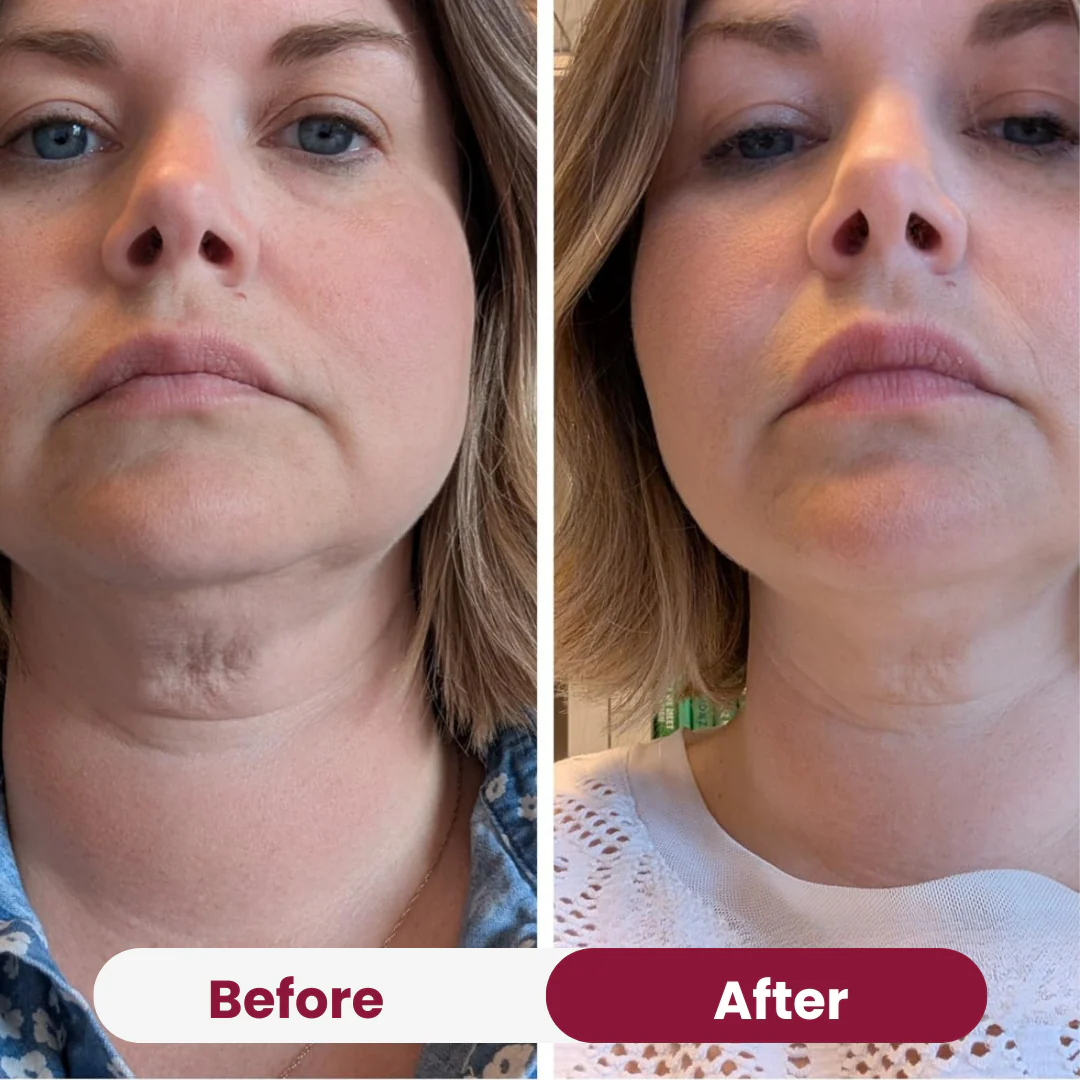 Neck Tightening Cream - Image 8