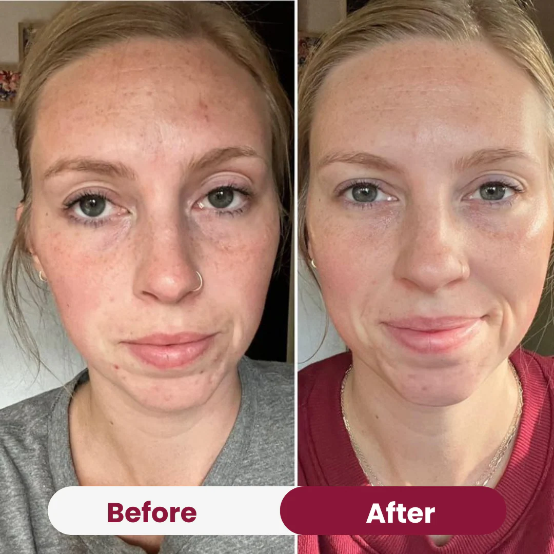 Radiant Niacinamide Real Deep Mask - Image 8