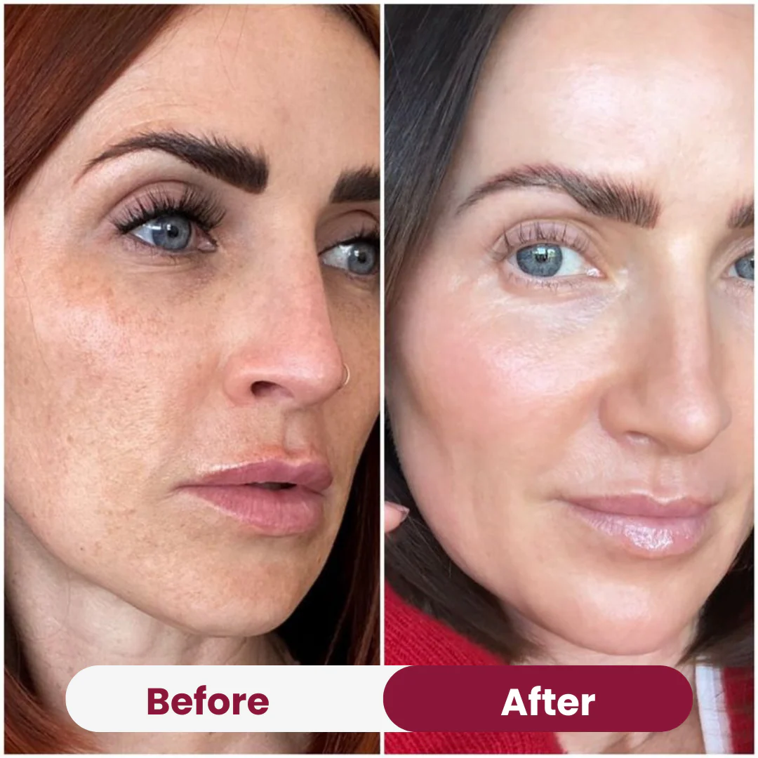 Salmon PDRN Collagen Mask - Image 4
