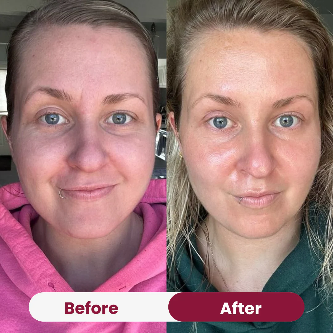 Salmon PDRN Collagen Mask - Image 5