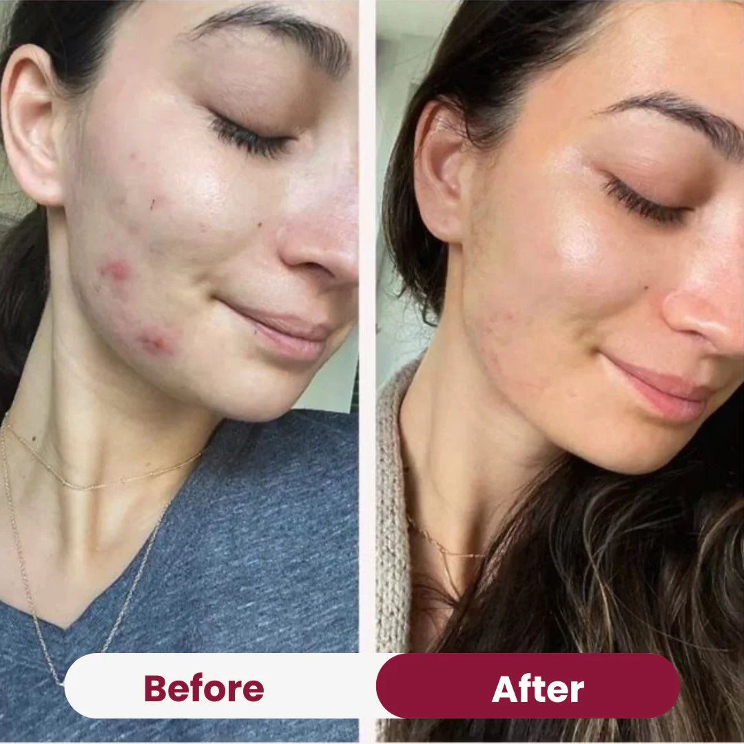 Zero Pore Pad - Image 4
