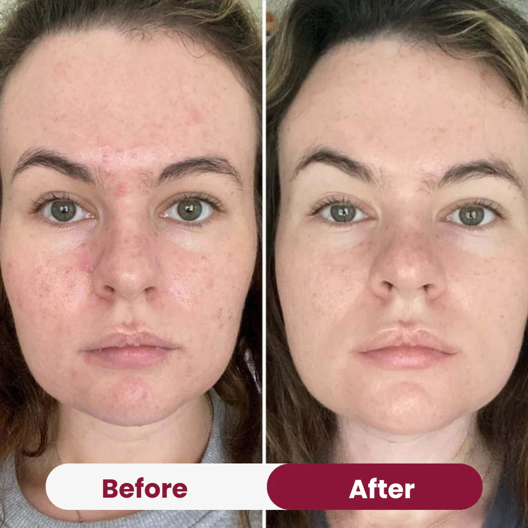 Zero Pore Pad - Image 6